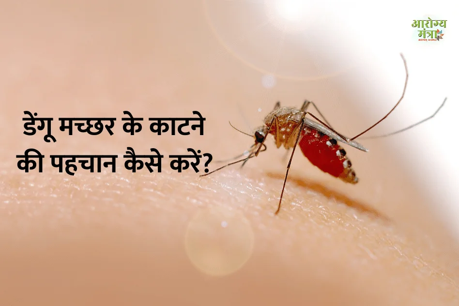  How to identify dengue mosquito : डेंगू मच्छर के काटने की पहचान कैसे करें?