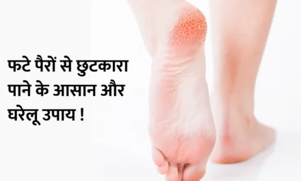 Get rid of cracked feet : फटे पैरों से छुटकारा पाने के आसान और घरेलू उपाय !