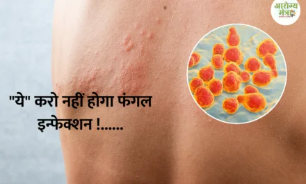 What are the causes of fungal infection : “ये” करो नहीं होगा फंगल इन्फेक्शन !……