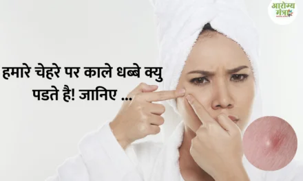 Why do we get dark spots on our face : हमारे चेहरे पर काले धब्बे क्यु पडते है! जानिए …