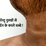 Remove neck black spots : ….इस घरेलू नुस्खों से हटाएं गर्दन के काले धब्बे !