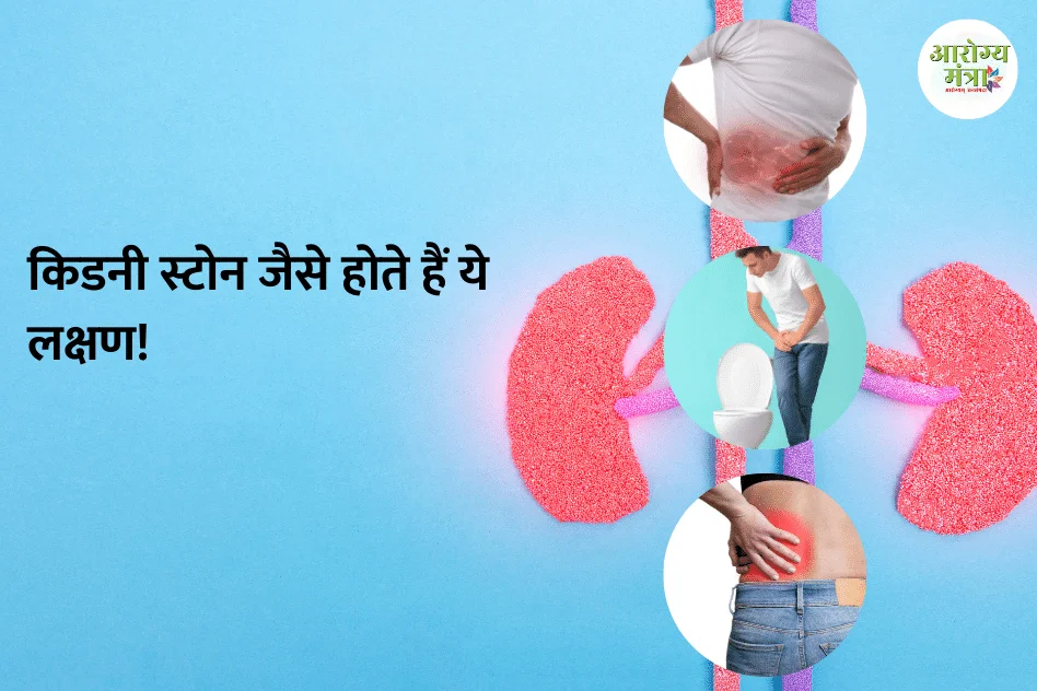 Kidney stones : किडनी स्टोन जैसे होते हैं ये लक्षण!