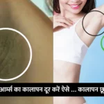 Get rid of dark underarms : अन्डरआर्म्स  का कालापन दूर करें ऐसे … कालापन छूमंतर