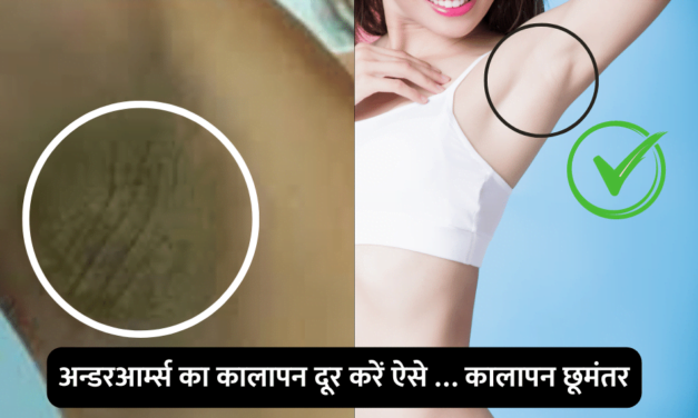 Get rid of dark underarms : अन्डरआर्म्स  का कालापन दूर करें ऐसे … कालापन छूमंतर