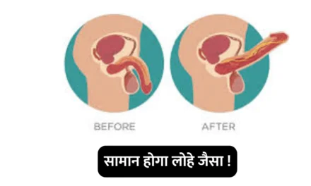 Get rid of erectile dysfunction : आपका “सामान” खड़ा नहीं हो रहा है , तो ये करो एकदम दमदार होगा !