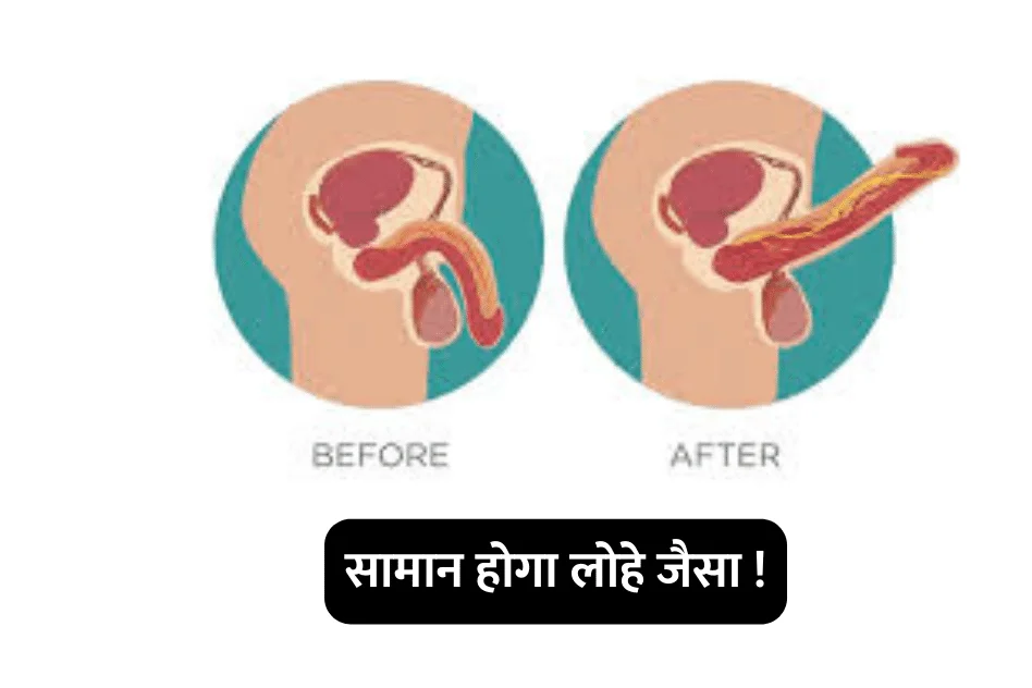 Get rid of erectile dysfunction : आपका “सामान” खड़ा नहीं हो रहा है , तो ये करो एकदम दमदार होगा !