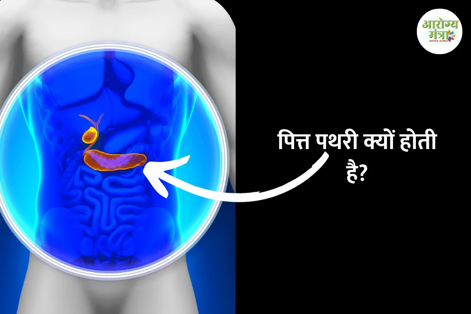 Why do gallstones occur : पित्त पथरी क्यों होती है?