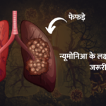 Pneumonia is a lung disease: निमोनिया एक फेफड़े की बीमारी है जिसमें फेफड़े बैक्टीरिया, वायरस और कवक से संक्रमित होते हैं !